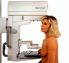 Маммография в Израиле фото 2